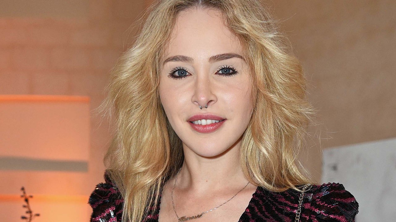 Krasse OP: Theresia Fischer lässt sich die Beine verlängern