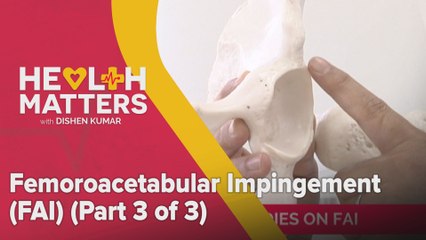 Health Matters: Femoroacetabular Impingement (FAI) - (Part 3 of 3)