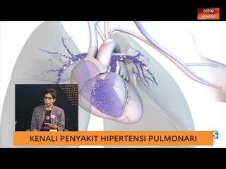 Sukar bernafas tanpa sebab tanda awal tekanan paru-paru tinggi