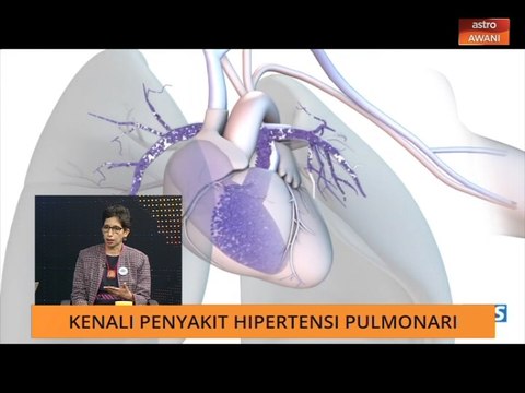 Sukar bernafas tanpa sebab tanda awal tekanan paru-paru tinggi