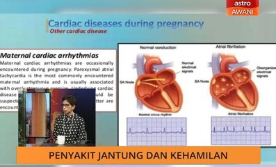 AWANI Pagi: Penyakit jantung dan kehamilan