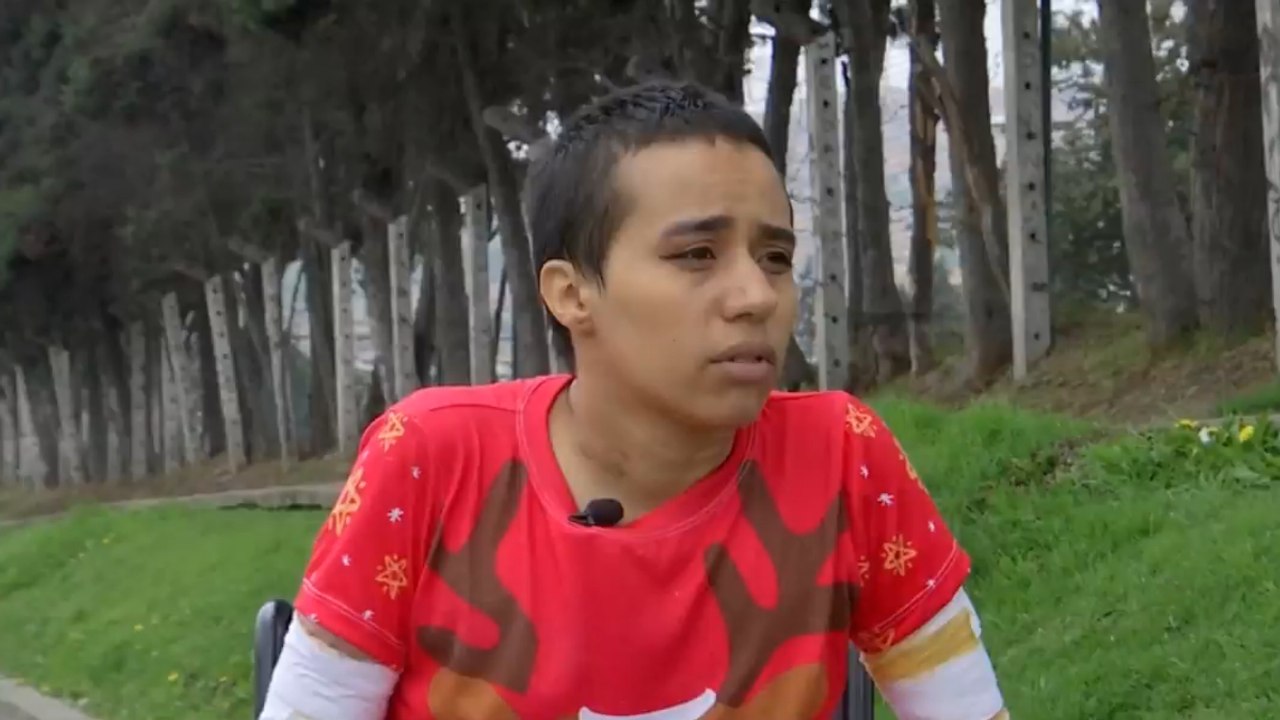 El duro relato de Laura Rincón, mujer víctima de brutal agresión por parte de su expareja