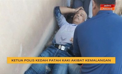 Ketua Polis Kedah patah kaki akibat kemalangan