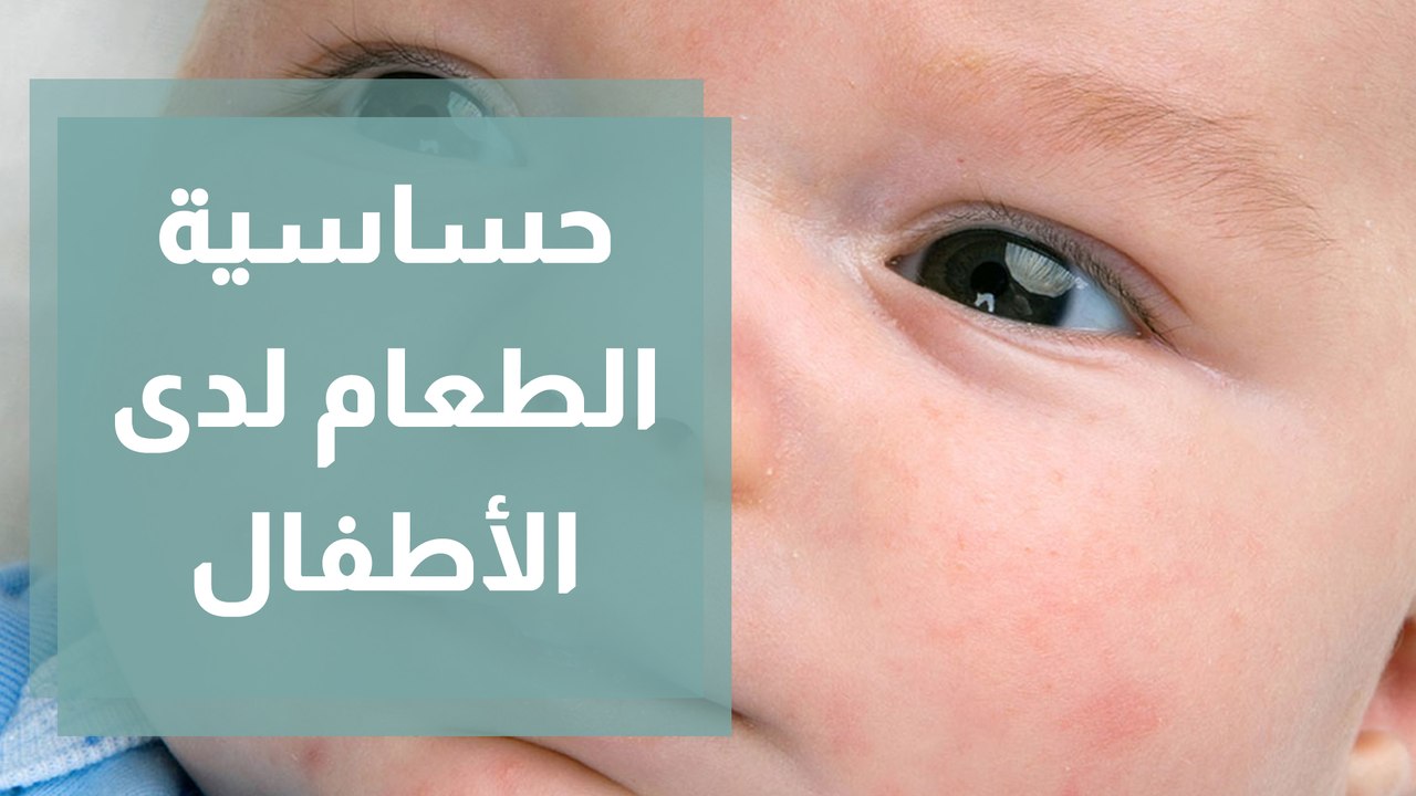 حساسية الطعام عند الأطفال