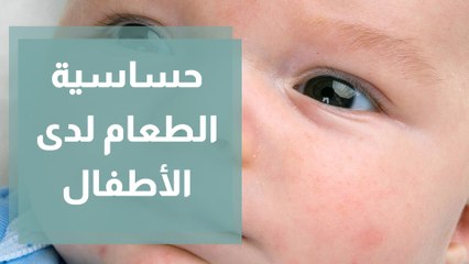 حساسية الطعام عند الأطفال