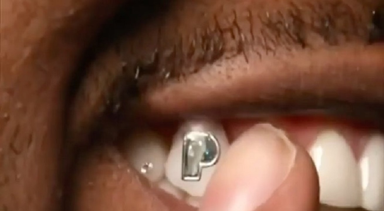 Gunna shows off $100,000 "Pushin P" diamond he placed on his tooth