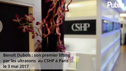 Exclu Vidéo : Benoît Dubois : "Mon lifting ? C’est pour réparer ma peau acnéique !"
