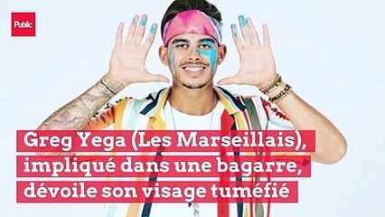 Greg Yega (Les Marseillais), impliqué dans une bagarre, dévoile son visage tuméfié