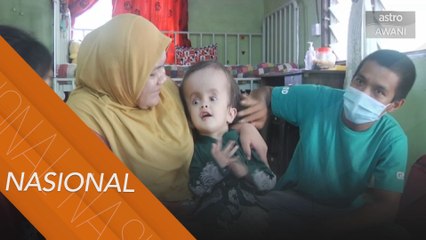 Keluarga pesakit Hydrocephalus buntu sejak PKP dilaksanakan