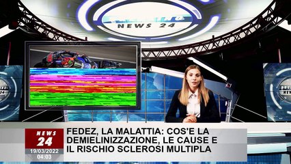 Fedez, la malattia: cos'è la demielinizzazione, le cause e il rischio sclerosi multipla