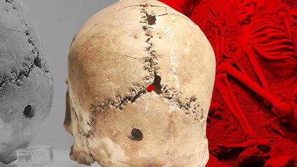 Dünyanın ilk beyin ameliyatı 10 bin 500 yıl önce Aksaray’da yapıldı