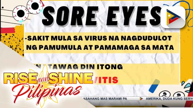 SAY NI DOK | Mga karaniwang tanong sa sakit na sore eyes, alamin!