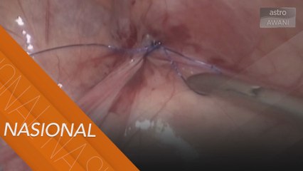 Stigma buat ibu bapa elak pembedahan rawat anak angin pasang