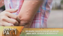 AWANI Pagi: Urtikaria (gegata) dalam kalangan anak anda. Adakah ia berbahaya?