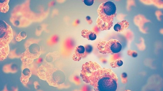 Yanlış 'kanser' teşhisi koyulan patoloji raporuna tazminat