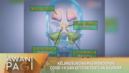 AWANI Pagi: Segala yang perlu anda tahu mengenai resdung