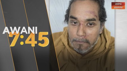 Khairy Jamaluddin kemalangan semasa berbasikal