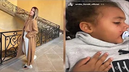 Emilie Fiorelli  Sa fille Louna a le visage bien amoché après un petit @ccident, une photo dévoilée