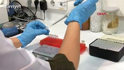 Hacettepe'den tıp literatürüne yeni sendrom