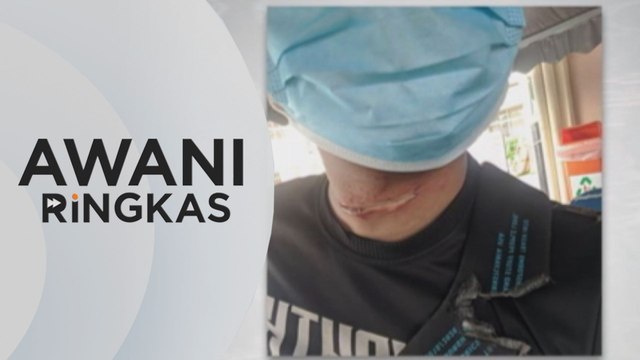 AWANI Ringkas: Dihiris tali tangsi, anggota polis cedera di leher | Samun duit taska, suspek sedang dikesan