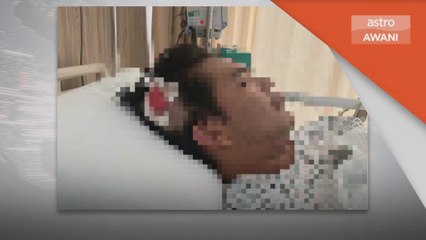 Kemalangan | Patah tujuh batang gigi akibat dibelasah