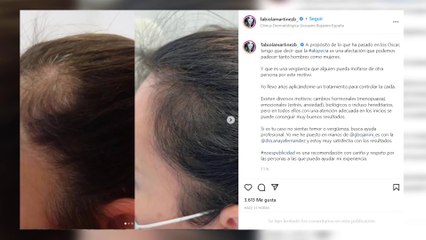 Fabiola Martínez desvela que sufre de alopecia y carga contra Chris Rock