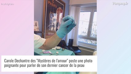 Carole Dechantre encore opérée pour un nouveau cancer : photo et message poignant