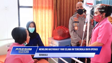 Polda Bengkulu Berkolaborasi dengan Unib-Train Smile Hadirkan Operasi Bibir Sumbing dan Langit-langit Gratis