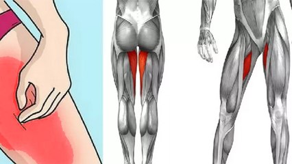 लगातार जांघ में दर्द से Heart Attack का खतरा कैसे, Palmonary Embolism क्या है | Boldsky