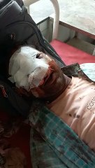 पेशी से धौलपुर लौट रहे  युवक की पत्नी और साले ने मारपीट कर काटी  नाक..देखें वीडियो