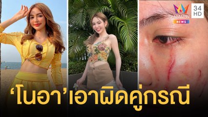 "โนอา ภญมณ" นักแสดงสาวถูกรุมตบกลางผับทองหล่อ ลุยแจ้งความคู่กรณี | ข่าวเที่ยงอมรินทร์ | 27 มี.ค.65