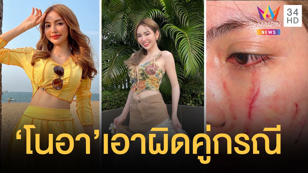"โนอา ภญมณ" นักแสดงสาวถูกรุมตบกลางผับทองหล่อ ลุ...