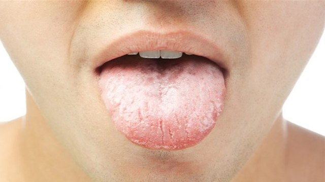 बार बार मुंह सूखना डायबिटीज का लक्षण | Bar Bar Muh Sukhne ka Karan | Boldsky