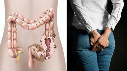 पाद रोकने से क्या होता है | पाद रोकने के नुकसान | Paad Rokne Se Kya Hota Hai | Boldsky