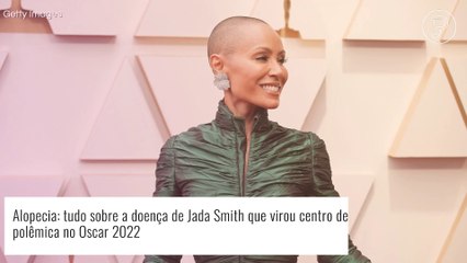 Alopecia: tudo sobre a doença de Jada Smith que virou centro de polêmica no Oscar 2022