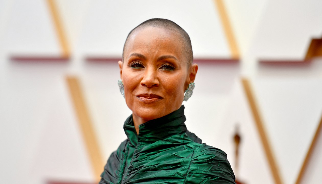 “La alopecia es mi mejor amiga”: la complicada...