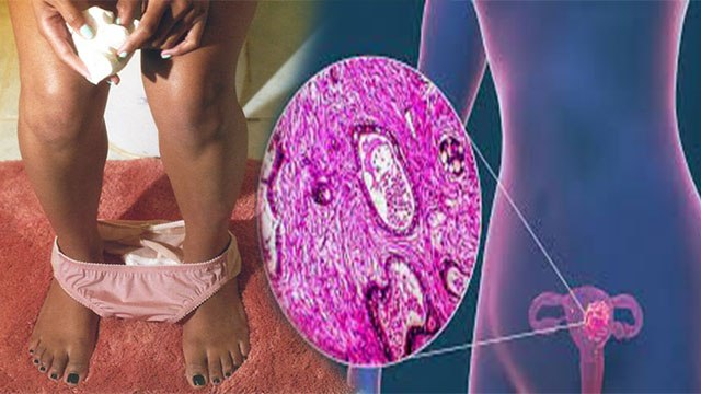 Cancer का खतरा इन महिलाओं में सबसे ज्यादा, Endometrial Cancer के Symptoms क्या है | Boldsky