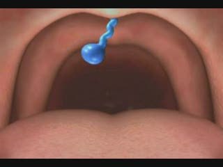 Under the Skin : Lutte interne