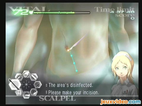 Trauma Center : Second Opinion : Anévrismes