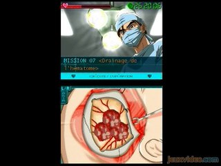 Lifesigns : A Coeur Ouvert : Trépanation crânienne