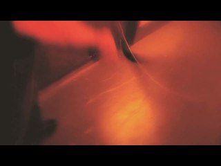 Dementium : L'Asile : Une balle dans la tête