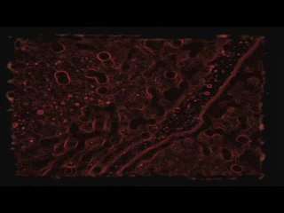 Dementium : L'Asile : Publicité n°1