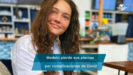 Claire, la modelo que, con vacunación completa, perdió ambas piernas por el Covid-19