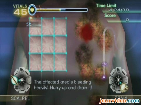 Trauma Center : New Blood : Greffe de peau