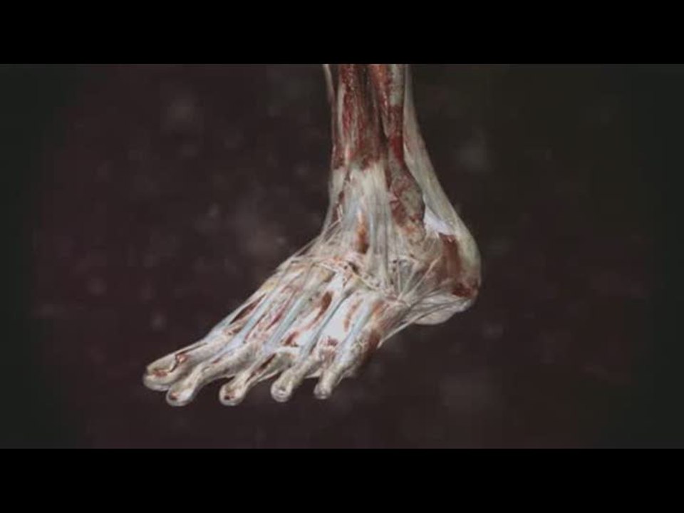 Blitz : The League II : Les blessures en gros plans