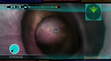 Trauma Team : Endoscopie