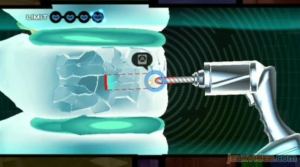 Trauma Team : 2/4 : Orthopédie et endoscopie