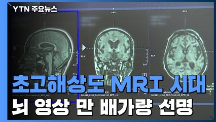 "뇌 영상 1만 배 선명하게"...초고해상도 MRI 시대 '성큼' / YTN