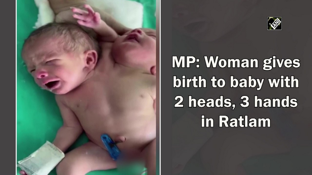 MP: Woman gives birth to baby with 2 heads, 3 h...