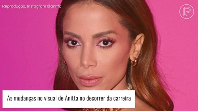 Antes e depois de Anitta: cantora mostra transformação após plásticas e ironiza visual